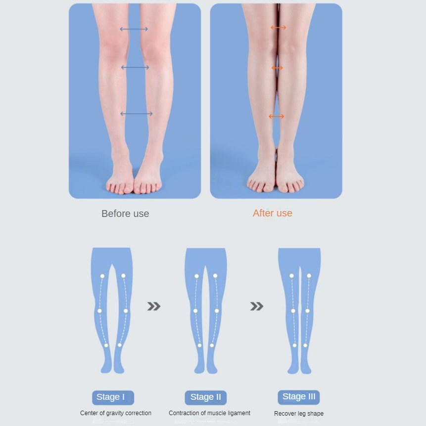 PU Orthotic Insole Arch Suppor - огляд і ціна Women Shoes Types